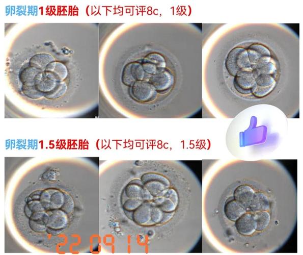 手把手揭秘沈阳试管助孕可以视频看胚胎吗 建议收藏