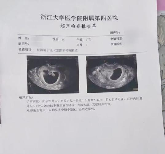 专业医生查看胚胎报告